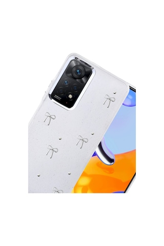 Newface - 256 - Xiaomi Redmi Note 11 Pro Fiyonk Desenli Kapak - - Spt-gld - Desen 5 Diğer