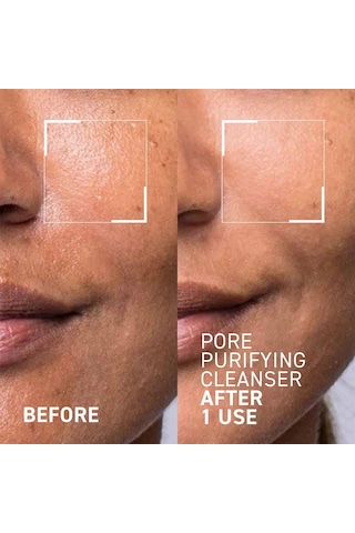 Dr.brandt Pores No More Pore Purifying Cleanser 105ml Cilt Temizleyici