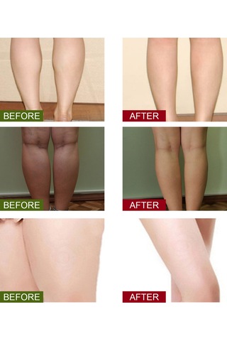 Qingmipy Zencefil, Safran Ve Pelin Özlü 20'li Ayak Detoksu Poşeti - Kan Dolaşımını Artırır Ve Ödemi Azaltır