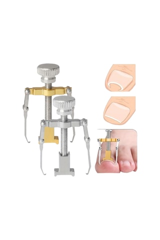 Akestoria Med Batık Tırnak Çıkarıcı Ve Düzeltici Aleti Fc-037 Standart