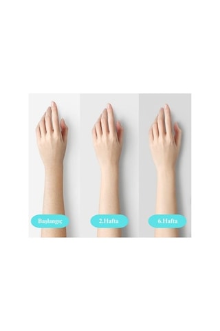 Otomatik Ve Manuel Atım Buz Lazer Epilasyon Aleti