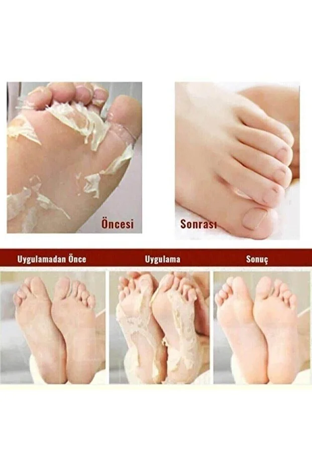 Soyulabilir Peeling Ayak Maskesi Peeling 3'lü