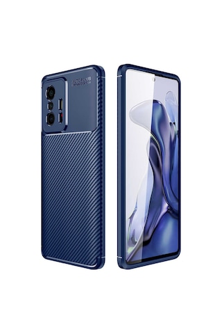 Xiaomi Mi 11T Kilif Lens Karbon Tasarim Negro Silikon Kapak 522480527