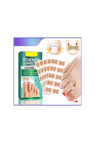 Yifomall 50 Adet Oýnaxan Tırnak Tamiri Seti - Ayak Tırnağı Yumuşatıcı Bandajı, Profesyonel Tırnak Düzeltme Yapistırıcısı