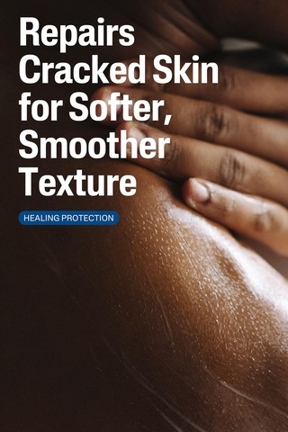 Cetaphil Çatlamış Cilt Onarıcı Losyon 473ml