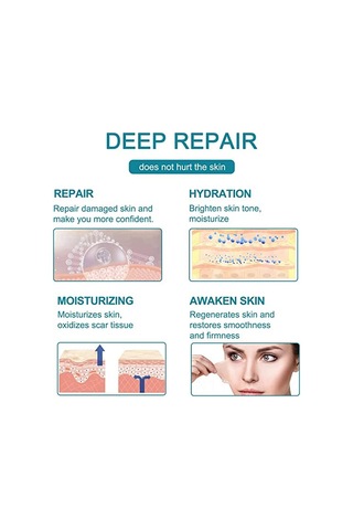 Tenfowee Yeniden Kullanılabilir Silikon Yara Bandı, Ameliyat, Yanık Ve Sezaryen İzleri İçin Su Geçirmez Ve Nefes Alabilir, 1.6 X 60 İnç