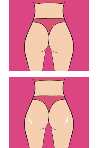 Skin Sensual Buttoks Strawberry Cheeks Vücut Maskesi | Çilek ve Tavuk Derisi Görünümüne Elveda | 2 Parça