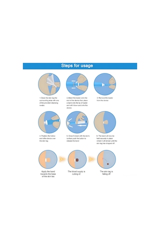Vkemall Et Beni Ve Siğil Çıkarma Seti: Ağrısız, Güvenli Ve Etkili Çözüm