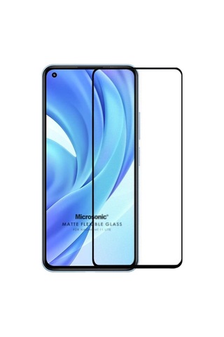 Xiaomi Mi 11 Lite Seramik Matte Flexible Ekran Koruyucu Siyah