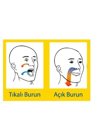 Medikalcim Horlama Önleyici Rahat Nefes Burun Aparatı-büyük 2 Adet