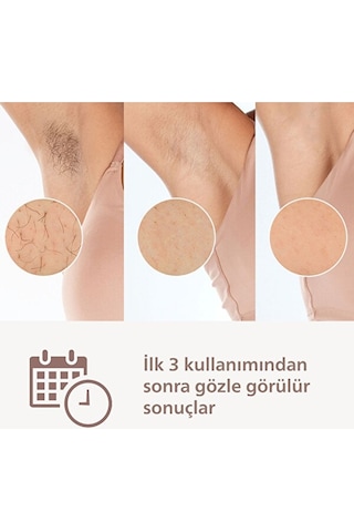 Philips Lumea Prestige Ipl Tüy Alma Cihazı + Vücut Ve Yüz Başlığı Brı950/00