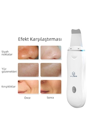 Yues Ultrasonik Spatula Yüz Temizleme Cihazı Siyah Nokta Temizlem