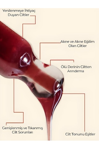 Ronna Beauty Akneli Ciltler İçin Red Peeling Serum 30 ML