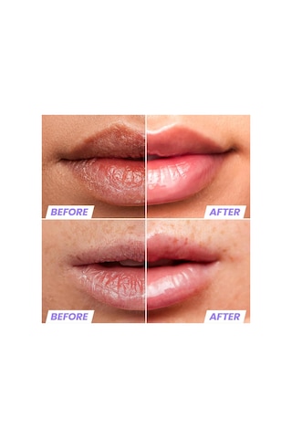 Wonderskin Lip Rehab Nemlendirici Ve Onarıcı Şeffaf Dudak Serumu Yağı Clear 3.57ml