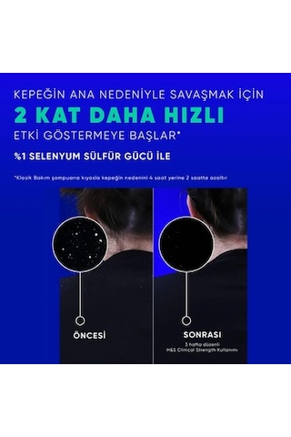 Head&shoulders Head & Shoulders Clinical Strength Cooling Itch Rescue Kaşıntı Karşıtı Şampuan 400