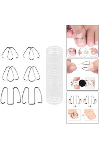 Dolıty 6 Adet Batık Ayak Tırnak Düzeltme Teli Kadın Erkek