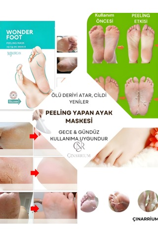 Ölü Deri Ve Çatlaklar Için Soyulabilen Ayak Peeling Maskesi 50ml Wonder Foot Peeling Maskesi