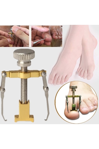 Ecoform Paslanmaz Çelik Batık Tırnak Çıkartma Aparatı Sarı