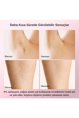 Pure Es T4 Taşınabilir Ipl Lazer Epilasyon Cihazı
