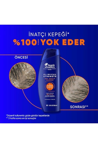 Head & Shoulders Clinical Strength Dry Scalp Rescue Kuru Saç Derisine Özel Şampuan 400 Ml Diğer