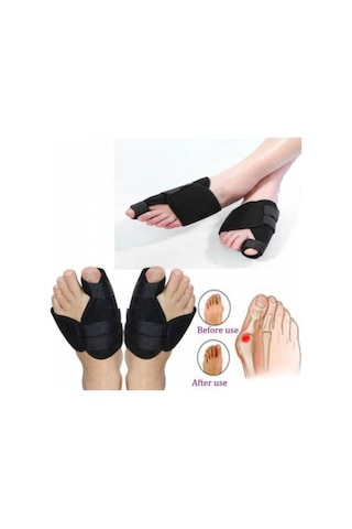 Halluks Valgus Gece Ateli Ayak Baş Parmak Kemik Çıkıntısı