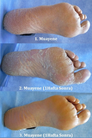 Beauty Foot Papatya ve Meyve Özlü Yenileyici Ayak Maskesi