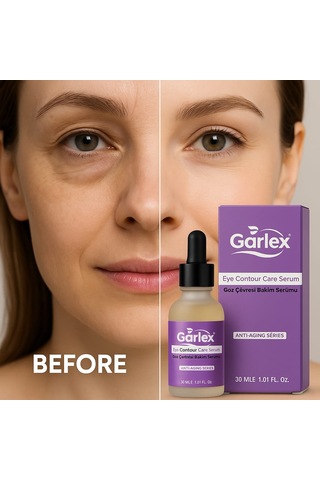 Garlex Göz Çevresi Bakım Serumu 30 ML