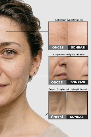 Retinal Shot Krem Göz Çevresi Alın Çizgisi Kırışıklık Karşıtı Pro Series C110