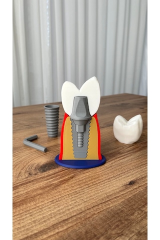 İmplant Modeli Diş Hekimliği Eğitici Model 13 CM