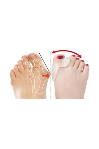 Ozclife Ayak Başparmak Koruyucu Kemik Çıkıntısı Önleyici