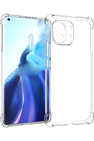 Xiaomi Mi 11 Lite Kamera Korumali Shockproof Seffaf Silikon Kili 514125793
