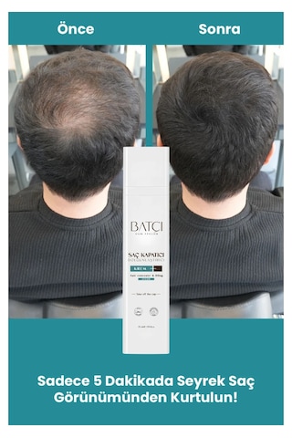 Saç Kapatıcı Dolgunlaştırıcı Sıvı Krem 50 Ml 10 Adet 1 Adet Tarak Hediyeli