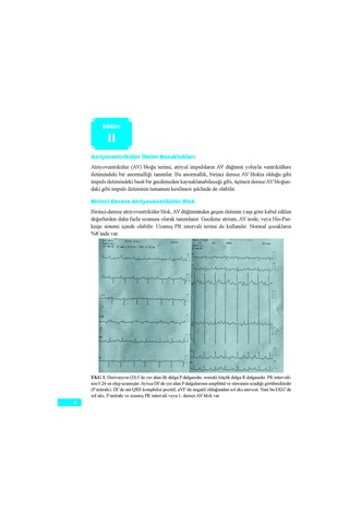 Normal Ve Patolojik Pediatrik Ekg Atlası