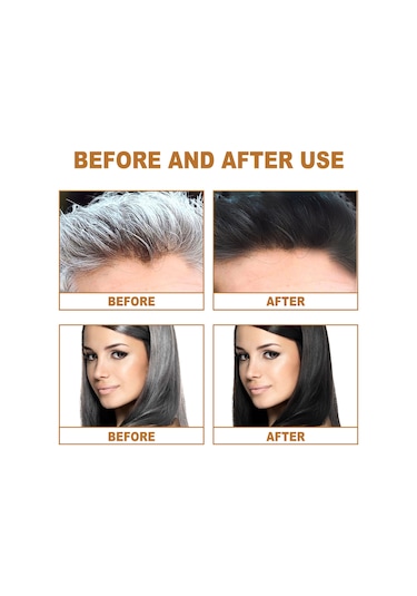 Vkemall Polygonum Multiflorum Saç Sabunu: Melanosit Üretimini Destekler, Saç Yapısını Onarır Ve Parlak Siyah Saçlar Sağlar Kuru - Yıpranmış