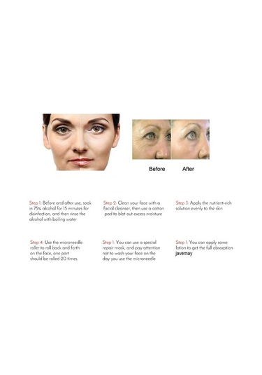 Beyaz 0.3mm Javemay Drs 540 Derma Rulo Mikro İğne Titanyum Mezoroller Saç Büyütme Cilt Bakımı Altın Vücut Rulosu Çok Renkli