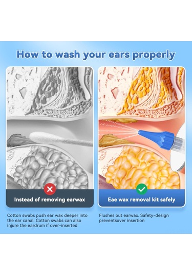 Moveevo Ev İçin Manuel Kulak Yıkama Aleti - Akışı Kontrol Ederek Yumuşakca Kulak Mumu Ve Atık Temizliği, Ev İçi Kulak Bakımı İçin Pratik Ve Hijyenik Beyaz