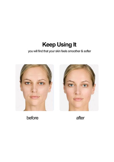 Youtek 13 Adet Silikon Kırışıklık Yama Seti - Alın, Yanak Ve Boyun İçin Anında Düzgünleştirici Cilt Bakımı