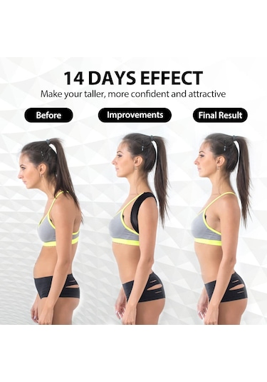 Dik Duruş Korsesi Duruş Düzeltici Skolyoz Sırt Omuz Korsesi