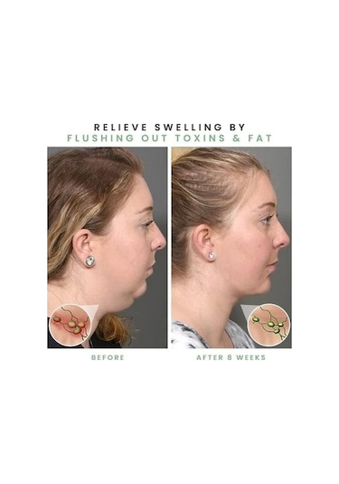 Besthome1 Kavrama Topu - Tpr Malzemeli, Çocuklardan Yetişkinlere Uygun, Suyla Yıkanabilir Top, Altın Renkli, Her Yaşta Kullanış Altın