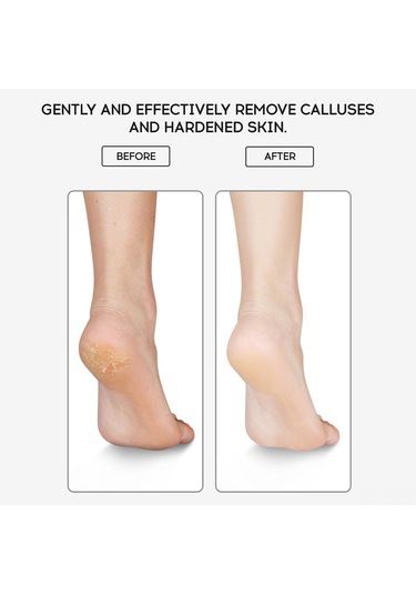 Hangfox Ev İçi Çift Uçlu Ayak Ölü Deri Silici - Paslanmaz Çelik 430 Koyu Renkli Aşınma Direnciyle Kuru Cilt Ve Kuru Deriyi Temizleyen Pedikür Aleti