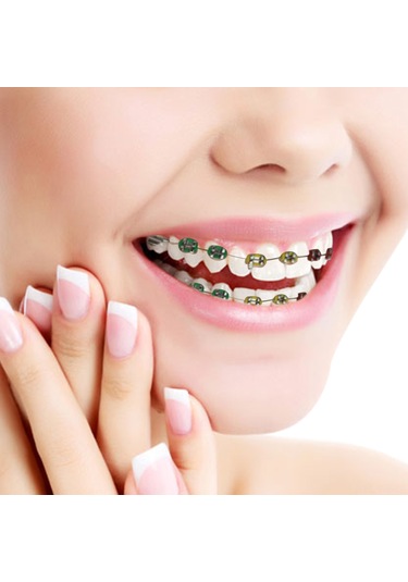 Wezone Diş Hekimi Eğitimi İçin Gerçekçi Simülasyon Aletleri - Çeşitli Renk Seçenekli Paslanmaz Çelik Sahte Braketler