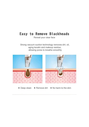 Siyah Nokta Temizleme Makinesi Elektrikli Akne Çıkarıcı Vakumlu Derin Gözenek Temizleyici Peeling Cihazı