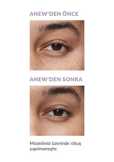 Avon Anew Düzgünleştirici Ve Tazeleyici Likit Kapatıcı 12 ML 31n Medium 0