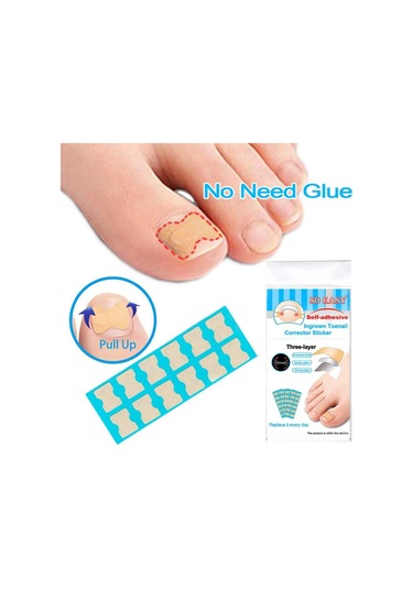 Suntek 1 Set Batık Ayak Tırnağı Düzeltici 72-yaprak