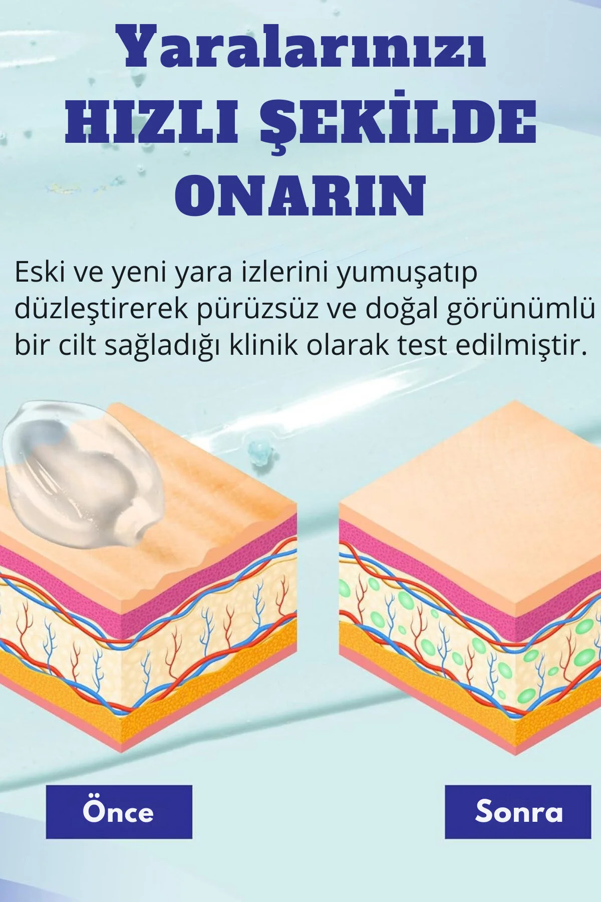 Aroamas Silikon Yara Jeli 30 ML