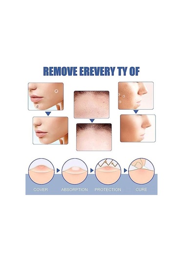 Mufunye Doğal İçerikli T-ag Cilt Yapışkanları - Tüm Cilt Tipleri İçin, 144 Adet, Su Geçirmez Ve Nefes Alabilir