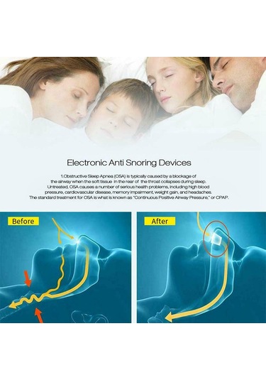 Mufunye Burun Tıkanıklığını Gideren Horlama Önleyici Cihaz, Abs Ve Silikon Malzeme, Kırmızı/mavi/beyaz Renk Seçenekleri