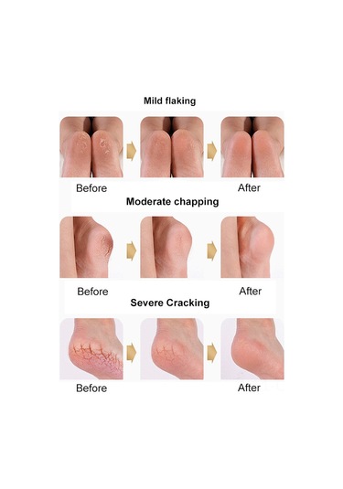 Qingmipy Yumuşak Silikon Topuk Koruyucu Çorap, Çatlak Önleyici, Uniseks, Yeşil, 1 Çift 34-45 Beden