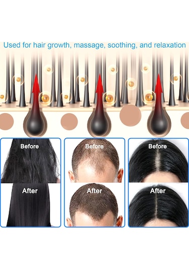 Xurunkeji Mod Elektrikli Masaj Tarağı Taşınabilir Kızılötesi Terapi Tarağı Başlardaki Saç Folikülleri Esans Yağı Aplikatörü, Gri