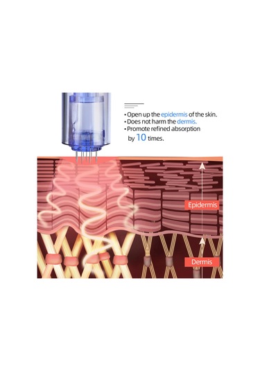 Vkemall Cilt Bakımı İçin 9 İğneli Değiştirilebilir Mikro İğne Uçları - 10'lu Paket